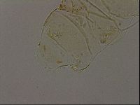 Echiniscus becki image