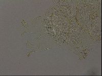 Echiniscus becki image