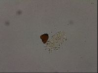 Echiniscus becki image