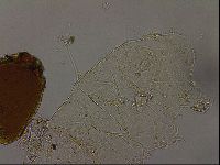 Echiniscus becki image
