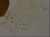 Echiniscus becki image