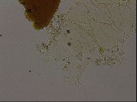 Echiniscus becki image