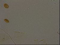 Echiniscus becki image