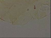 Echiniscus becki image