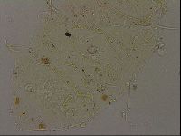 Echiniscus becki image