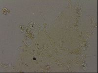 Echiniscus becki image