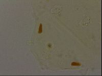 Echiniscus becki image