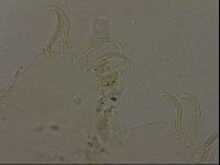 Echiniscus becki image