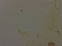 Echiniscus becki image