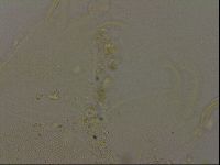 Echiniscus becki image