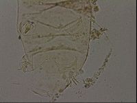 Echiniscus becki image