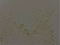 Echiniscus becki image
