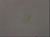 Echiniscus becki image