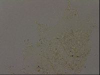 Echiniscus becki image