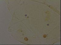 Echiniscus becki image