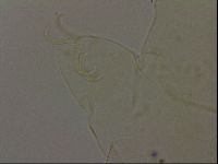 Echiniscus becki image