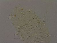 Echiniscus becki image