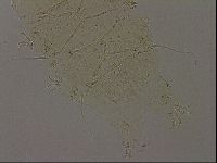 Echiniscus becki image