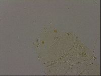 Echiniscus becki image