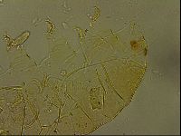 Echiniscus becki image