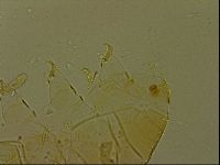 Echiniscus becki image