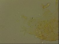 Echiniscus becki image