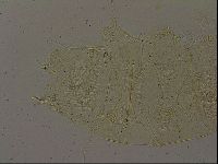 Echiniscus becki image