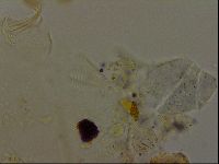 Echiniscus becki image