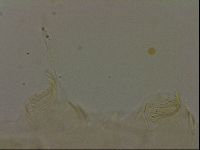 Echiniscus becki image