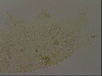 Echiniscus becki image
