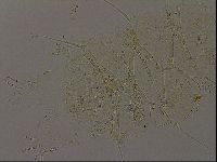 Echiniscus becki image
