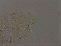 Echiniscus becki image