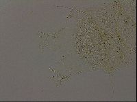Echiniscus becki image