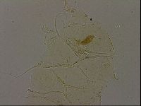 Echiniscus becki image