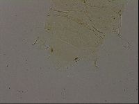 Echiniscus becki image