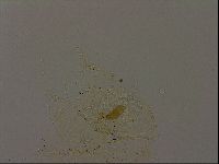 Echiniscus becki image