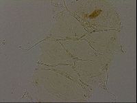 Echiniscus becki image
