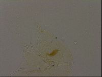 Echiniscus becki image