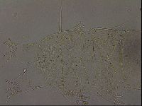 Echiniscus becki image