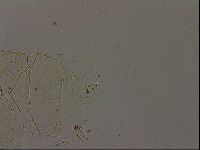 Echiniscus becki image
