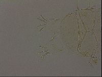 Echiniscus becki image