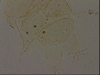 Echiniscus becki image