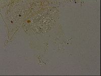 Echiniscus becki image