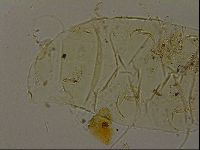 Echiniscus becki image