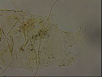 Echiniscus becki image