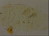 Echiniscus becki image