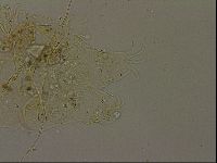 Echiniscus becki image