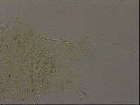 Echiniscus becki image