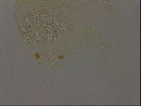 Echiniscus becki image