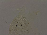 Echiniscus becki image
